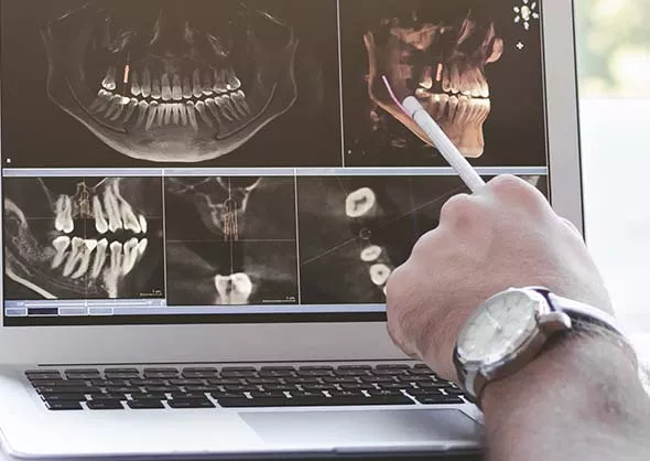 Laptop screen with X-Rays. Hand pointing at screen.